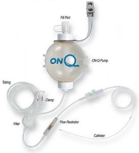 Avanos Medical ON-Q Pump Kits with ON-Q SilverSoaker Catheter - ON-Q Fixed Flow Pump Kit with SilverSoaker Catheter, 26.5", 400 mL x Dual 2 mL / HR - PM028-A