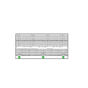 Cardinal Health Fetal Paper - Fetal Paper, 5.98" x 47' - 9656