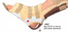 Restorative Care Multi Podus System - Nonactive Multi Podus Orthosis, Size XL - 10MP-XL