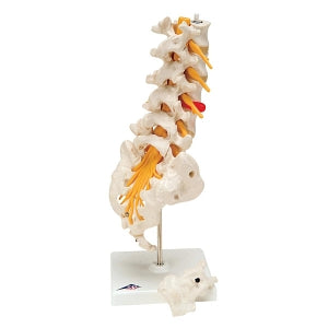 Fabrication Enterprises Inc Lumbar Spinal Column Anatomical Model - MODEL, ANATOMICAL, PROLAPSED LUMBAR - 12-4543