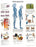 Fabrication Enterprises Inc Paper Anatomical Charts - CHART, ANATOMICAL, OSTEOPOROSIS, PAPER - 12-4615P