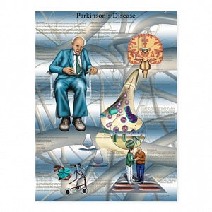 Fabrication Enterprises Inc Laminated Anatomical Charts - CHART, ANATOMICAL, PARKINSONS, LAMINATED - 12-4616L