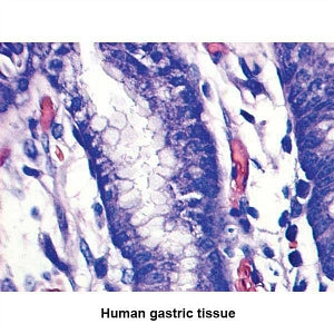 MarketLab Optimized Giemsa Stain Kit Kit - CONTROL SLIDES, BONE MARROW - 7314