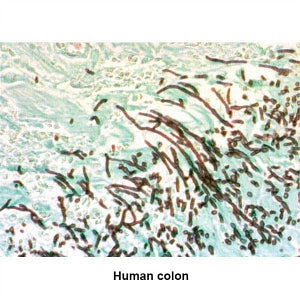 MarketLab G. M.S. Stain Set - CONTROL SLIDES, PNEUMOCYSTIS - 7379