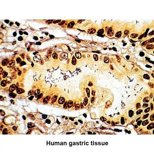 MarketLab Warthin-Starry Stain Kit - CONTROL SLIDES, SPIROCHETE - 7380