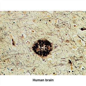 Marketlab Modified Bielschowsky Stain Kit - CONTROL SLIDES, ALZHEIMER - 7382