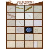 Urine Sediments Poster II - 19"W x 24"H