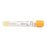 BD Vacutainer SST - Gold - 13 x 100mm 5mL