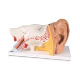 Ear Model 3 Times Life Size 6-Part Ear Model - 3 Times Life-Size - 6-Part