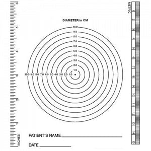 Stradis Healthcare Wound Measuring Devices - Wound Measurement Guide, Bullseye - BE-100