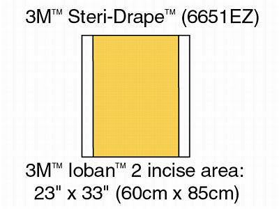 Ioban 2 Antimicrobial Incise Drape 6651EZ by 3M Healthcare