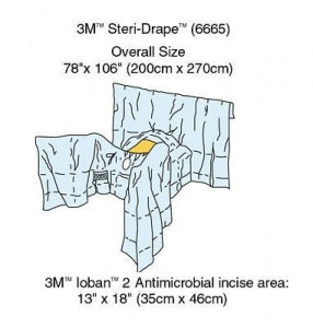 3M Healthcare Abdominal-Perineal Drapes 6665 - Ioban 2 Steri-Drape Abdominal-Perineal Drape with Accessories - 6665