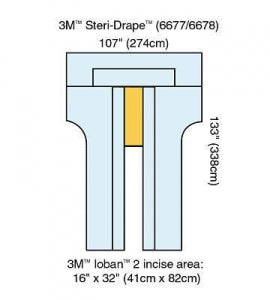 3M Cardio Vascular Steridrapes - Steri-Drape Cardiovascular Sheet with Ioban 2 Incise Film, 100" L x 150" W - 6677