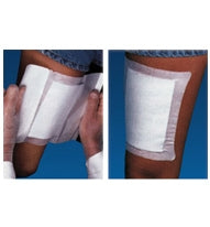 Adhesive Bandages