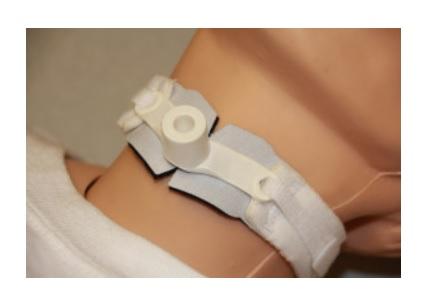 Two-Piece Tracheostomy Collar by Marpac