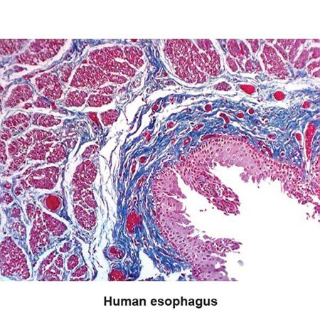 Masson Trichrome Stain Set Pint Set