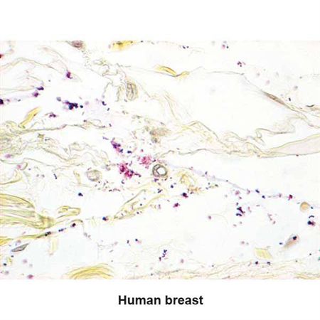 McDonald's Gram Stain Set Gram Positive/Gram Negative Control Slides