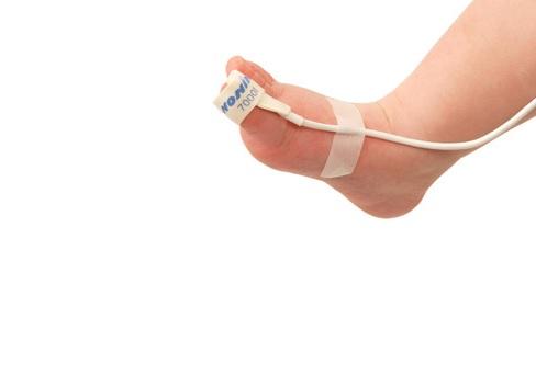 Flexiform III Sensors by Nonin Medical