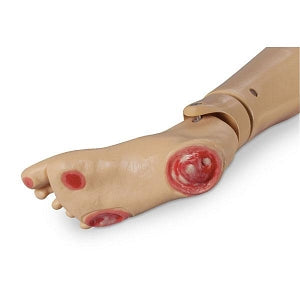 Nasco Life / form Optional Pressure Ulcer Foot - Life / form Foot Ulcer Patient Care Manikin - LF04041U