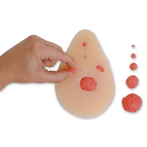 Nasco Breast Model with Interchangeable Nodules - Breast Model, 5 Interchangeable Nodules - SB23327U