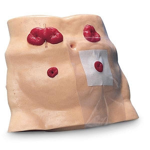 Nasco Global Ostomy Care Model - MODEL, OSTOMY CARE - SB23501U