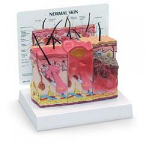 Nasco Skin Burn / Normal Educational Training Model - Skin Burn / Normal Educational Training Model, 6" x 2-1/2" x 4" - SB46482U