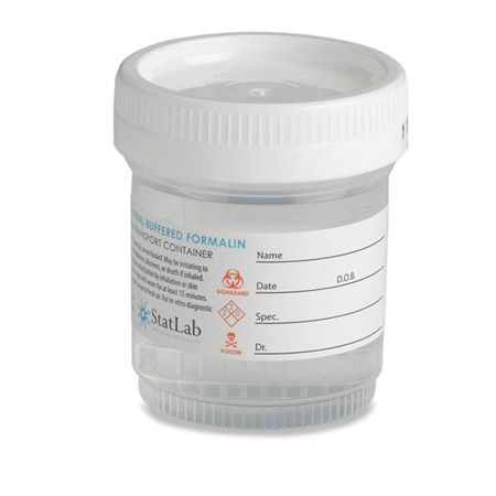 Neutral Buffered Formalin Pre-Filled 10% NBF - 60mL vial/30mL Fill