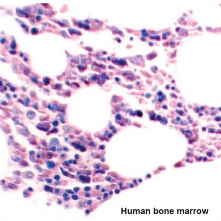 Optimized Giemsa Stain Kit Pint Kit