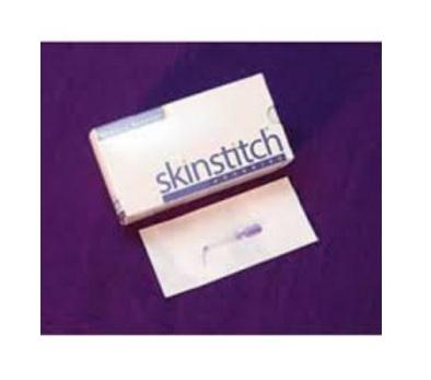 Skinstitch Adhseive by Progressive Medical