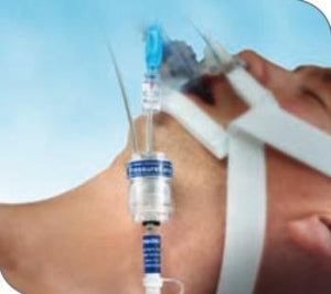 Smiths Medical SecureEasy Endotracheal Tube Holders - Secure Easy Endotracheal Tube Holder - 242003