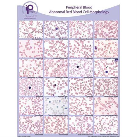 Peripheral Blood Cards Abnormal RBC Morphology Binder Cards