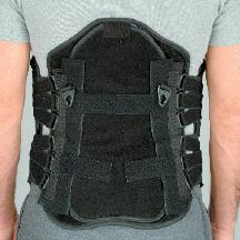 Ultralign Lumbar Sacral Orthoses by DeRoyal