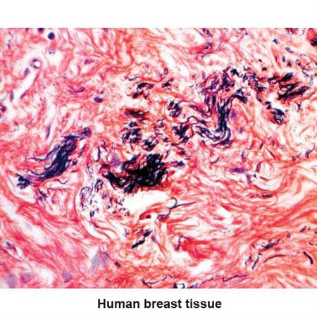 Russell-Movat Pentachrome Kit Striated Muscle Control Slides