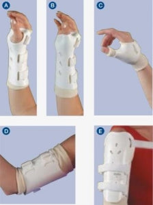 BSN Medical Specialist Fracture Bracing - Wrist / Hand Orthosis, Right, Size M - 61541