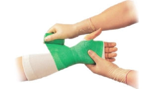 BSN Medical Delta-Cast Elite Polyester Cast Tapes - Delta Polyester Cast Tape, Green 2" x 4 Yd. - 7345400