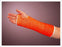 BSN Medical Delta-Cast Elite Polyester Cast Tapes - Delta Polyester Cast Tape, Orange 2" x 4 Yd. - 7345600