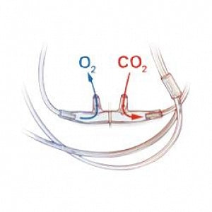 Salter Labs Divided SOFT CO2 Sampling / O2 Delivery Cannula - Divided Oral / Nasal Cannula, ETCO2 Filter, 7' O2 Line, 6' ETCO2 Line - 4MSF2-L-PED-7-6-25