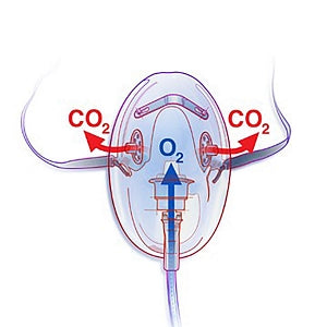 Monitor Mask CapnoVue Scope Breathing Masks - Capnovue Scope Co2 Mask, Male Luer Lock Connector, 7' - 1001-A-50