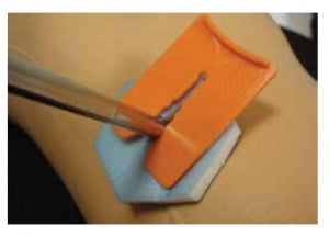 Smith & Nephew ACTICOAT Antimicrobial Barrier Dressings - Acticoat Antimicrobial Exfix Wound Dressing 6" x 10" - 66800637