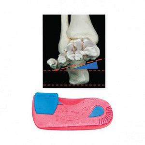 Vasyli Medical Orthotic Varus Forefoot Wedge - Varus Forefoot Wedge, 6-Degree - 081329127