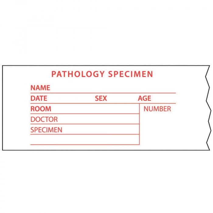 Tape Removable Pathology Specimen 1" Core 2" X 500" Imprints White 143 500 Inches Per Roll