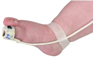 Tri-Anim Health FlexiWrap Sensor Wrap - FlexiWrap Sensor, Infant - 617-8008JFW