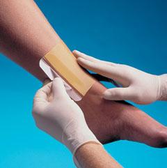 Replicare Hydrocolloid Dressings by Smith & Nephew