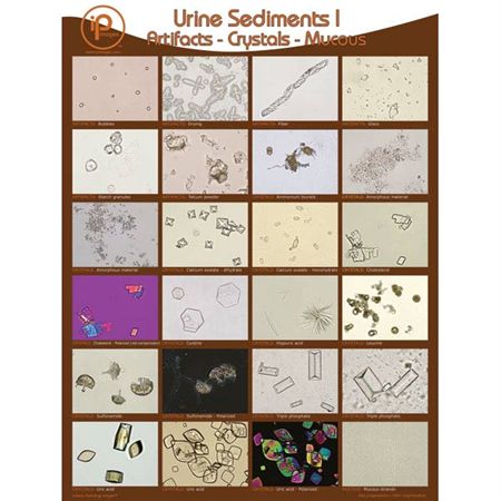 Urine Sediments Student Binder Cards II - 8.5"W x 11"H