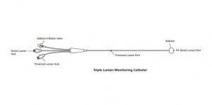 Edwards Lifesciences Swan-Ganz Pulmonary Artery Catheters - Swan Ganz Double Lumen Catheter, 5 Fr - 110F5