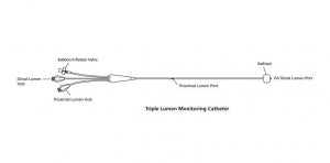 Edwards Lifesciences Swan-Ganz Pulmonary Artery Catheters - Swan Ganz Catheter, High Torque - T123F6