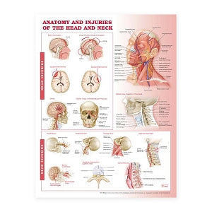 Wolters Kluwer Anatomy and Injuries of the Head and Neck Chart - Anatomy and Injuries of the Head and Neck Chart, Paper - 9780781786706