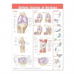 Wolters Kluwer Athletic Injuries of the Knee Anatomical Chart - Athletic Injuries of the Knee Anatomical Chart, Laminated - 9780781786751