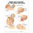 Wolters Kluwer Whiplash Injuries of the Head and Neck Anatomical Chart - Whiplash Injuries of the Head and Neck Anatomical Chart, Laminated - 9781587793752