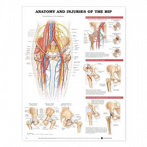 Wolters Kluwer Anatomy and Injuries of the Hip Chart - Anatomy and Injuries of the Hip Chart, Paper - 9781587793820